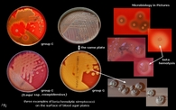 beta hemolytical streptococci